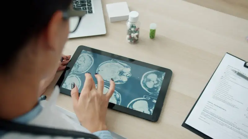 Doctor scrolling through a series of brain scan images on a tablet at a desk