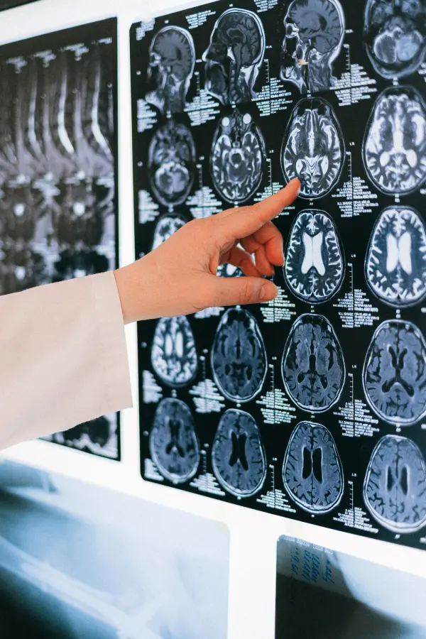 Hand pointing to brain scan imagery on a lightbox