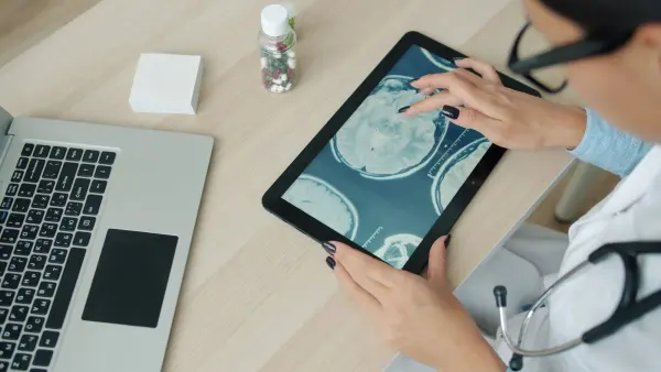 Medical professional reviewing brain scan images