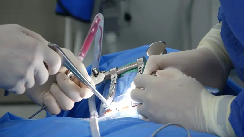 Gloved surgeons' hands holding a retractor and forceps over blue sterile drapes