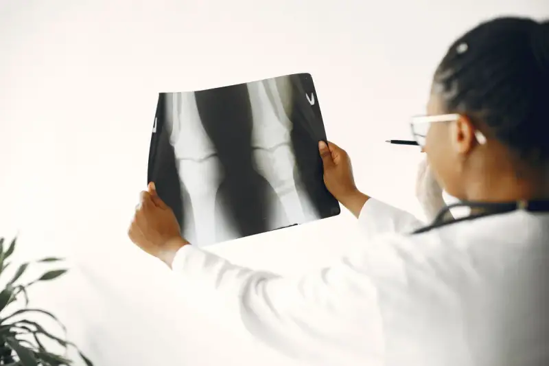 Woman doctor in a white coat holding up a knee X-ray film and studying it