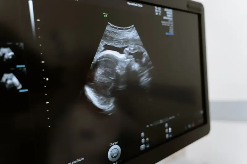 Ultrasound monitor showing a fetal scan in a medical clinic