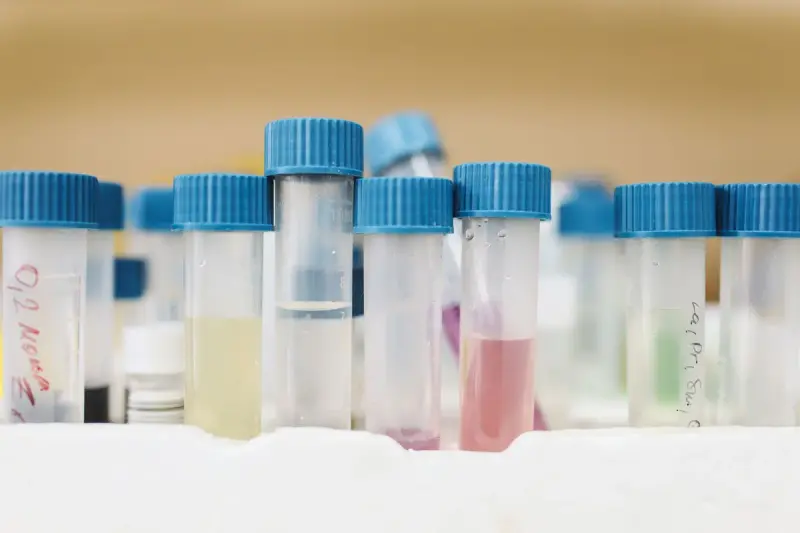 Close-up of test tubes with blue caps holding colored samples