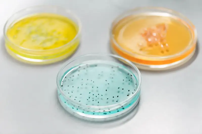 Petri dishes with colored cultures stacked on a laboratory bench