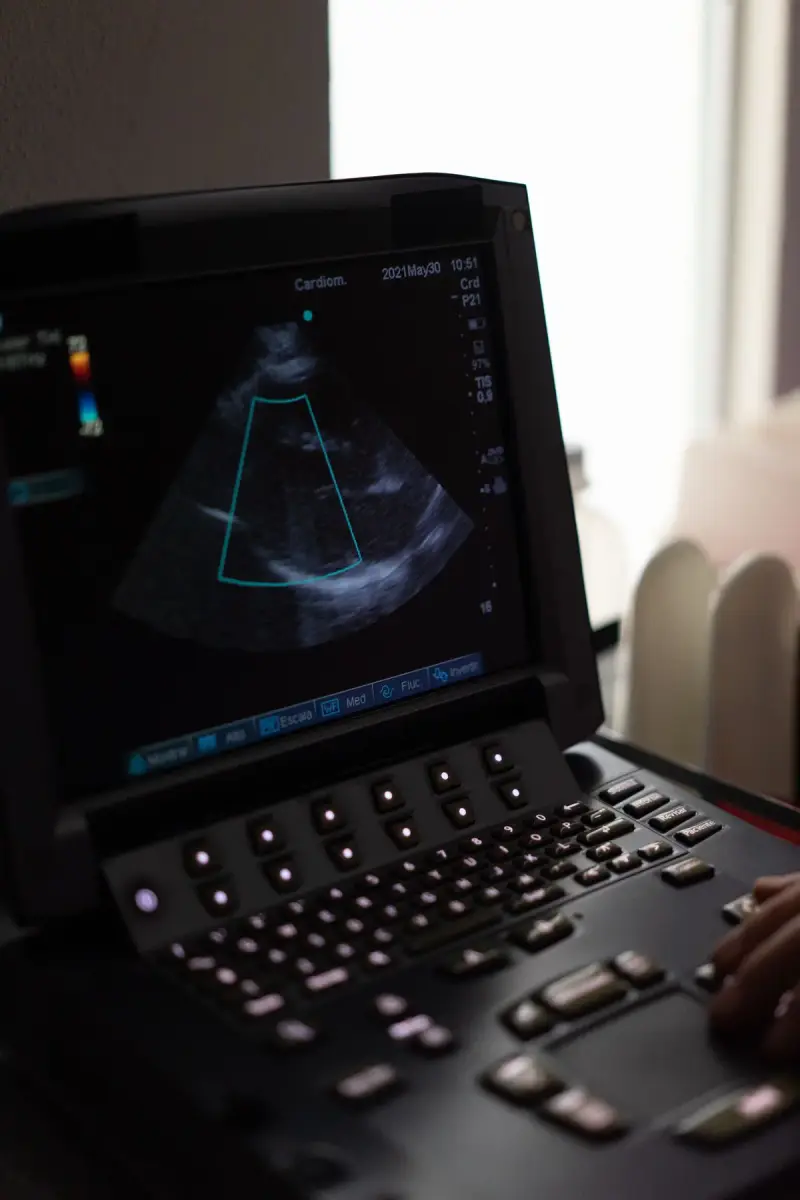 Portable ultrasound screen showing a cardiac image with a color Doppler box above a lit keyboard