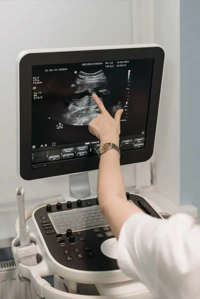 Clinician points to a detail in an ultrasound image on the monitor of a scanning console