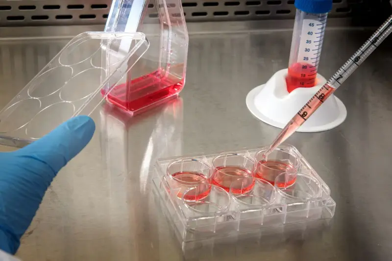 Gloved hand working with culture samples at a laboratory bench