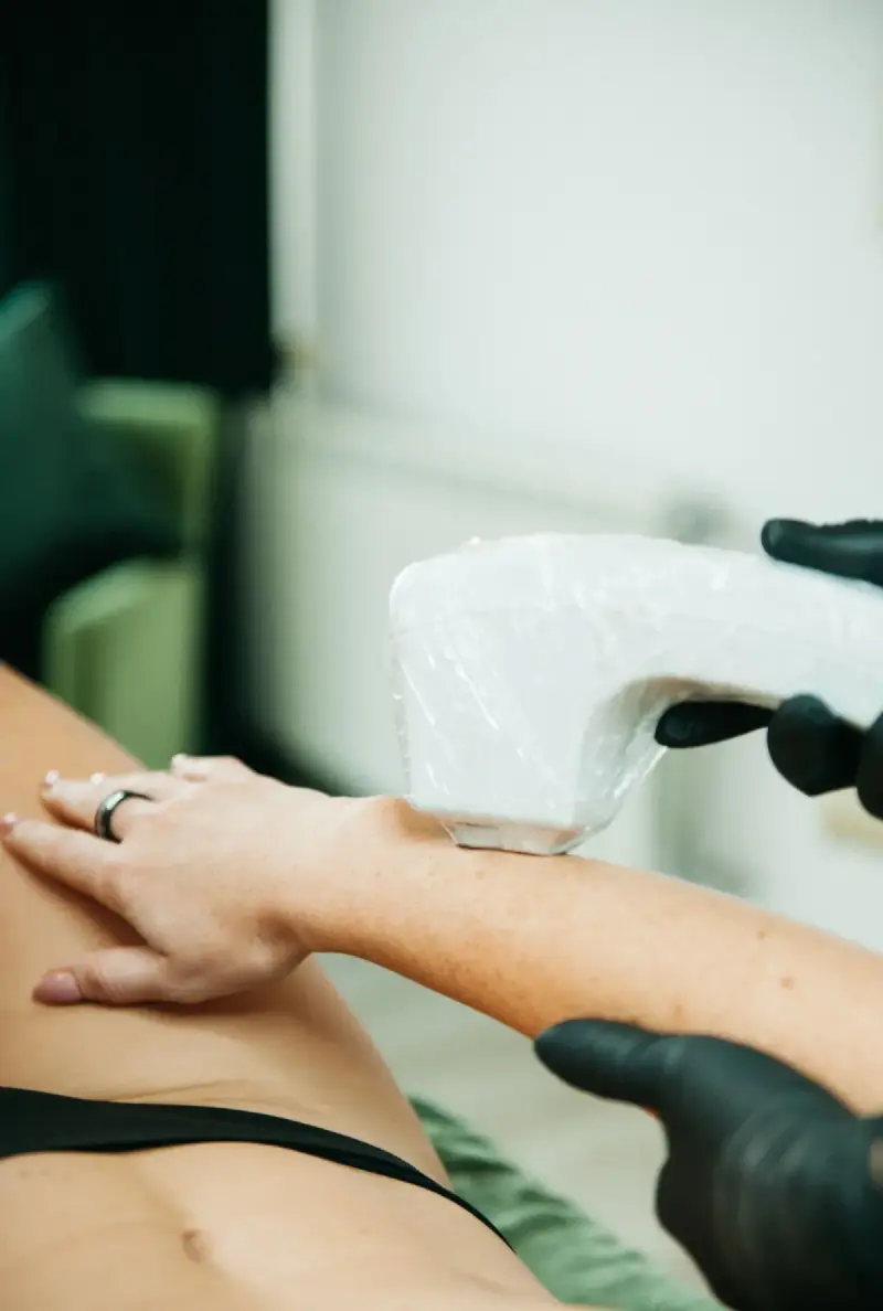 Close view of a laser device being used on an arm