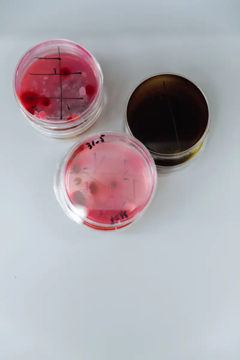 Top view of petri dishes showing bacterial colonies growing on agar