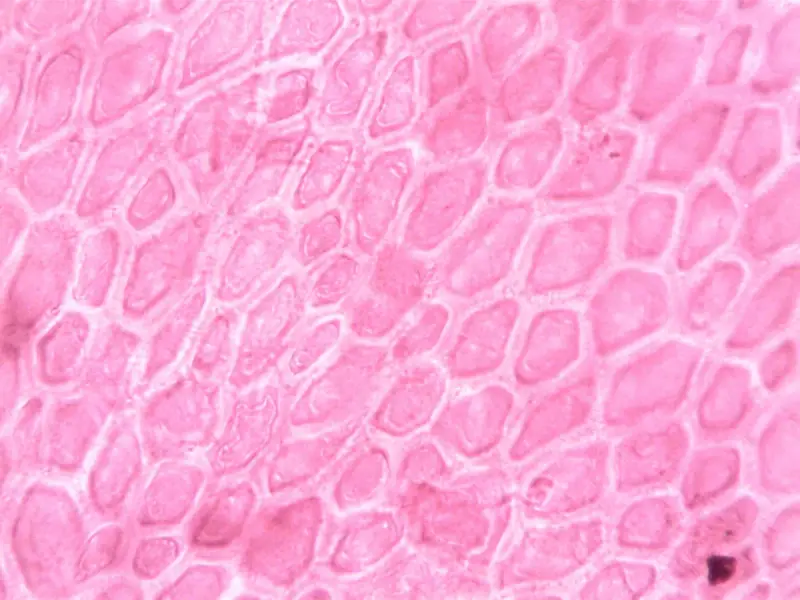 Pink cell structures seen through a microscope at high magnification