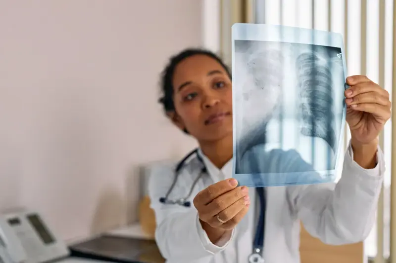 Physician with a stethoscope holding a chest X-ray up to the window light