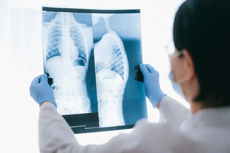 Gloved clinician in a mask holding front and side chest X-ray films