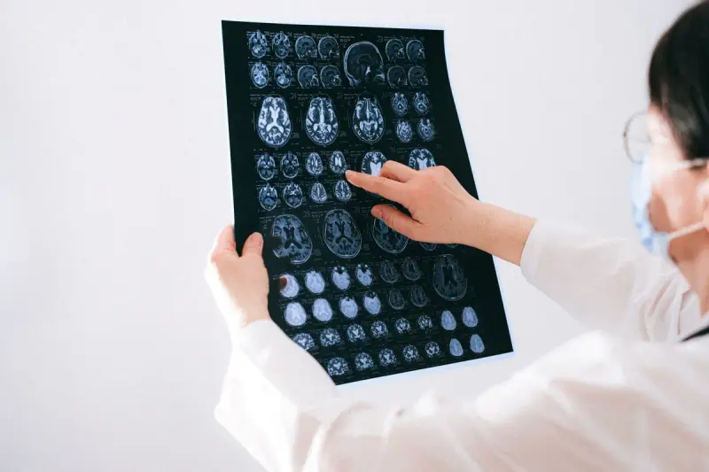 Woman doctor in glasses and a mask pointing at a sheet of brain MRI images