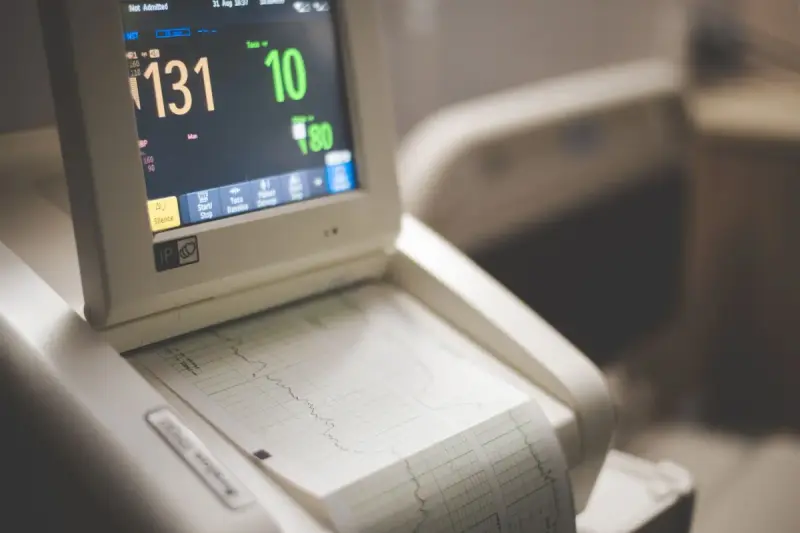 Bedside cardiac monitor showing heart rate readings above a strip of printed rhythm paper