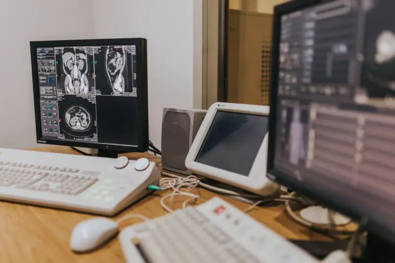 MRI scan images displayed across several monitors at a hospital workstation