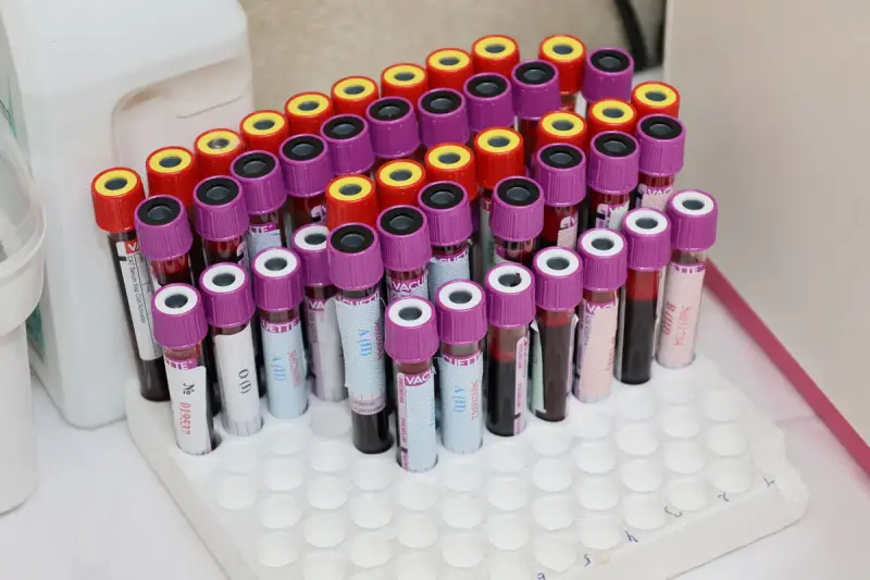 Rows of capped blood sample tubes standing in a white laboratory rack