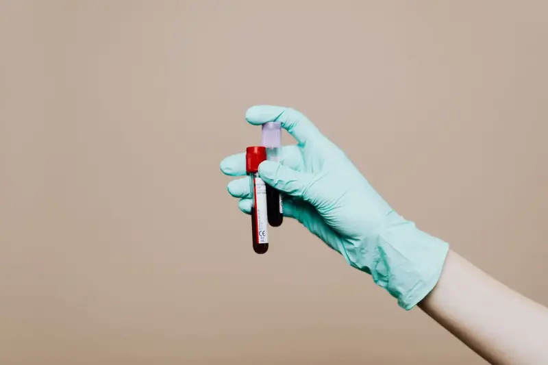 Gloved hand holding a capped blood sample tube against a beige background