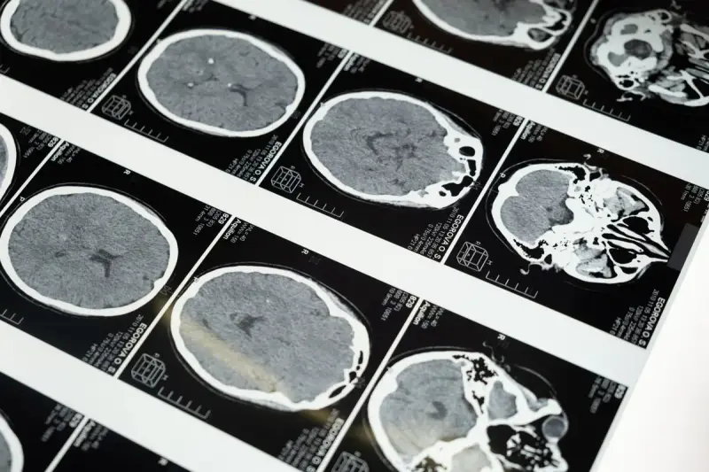 Rows of brain MRI slices displayed on a lightbox