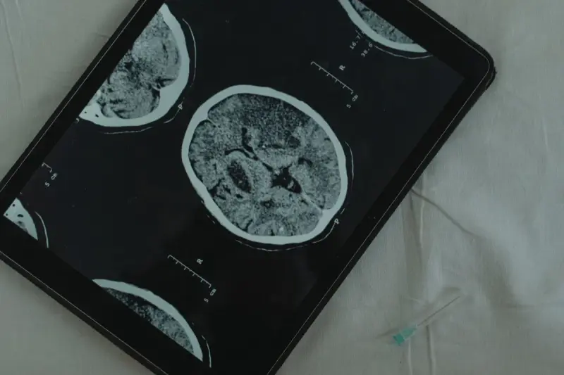 Axial brain CT scan images displayed on a tablet resting on white bedding