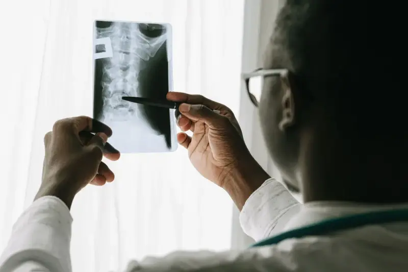 Doctor holding a cervical spine X-ray up to window light and pointing with a pen