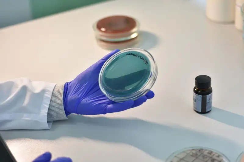 Gloved hand holding a teal agar plate at a white lab bench