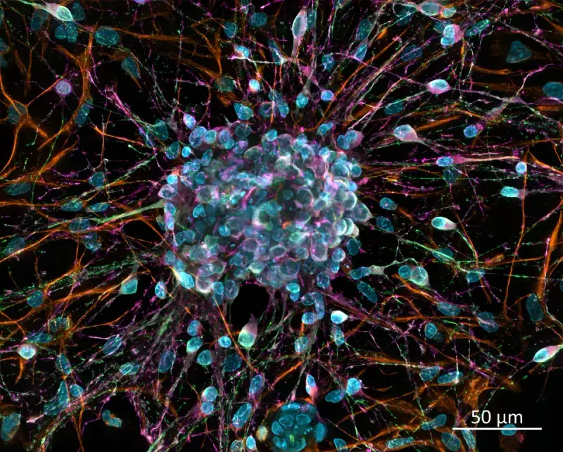 Fluorescent image of cultured cortical neurons spreading colorful branching fibers from a central cluster