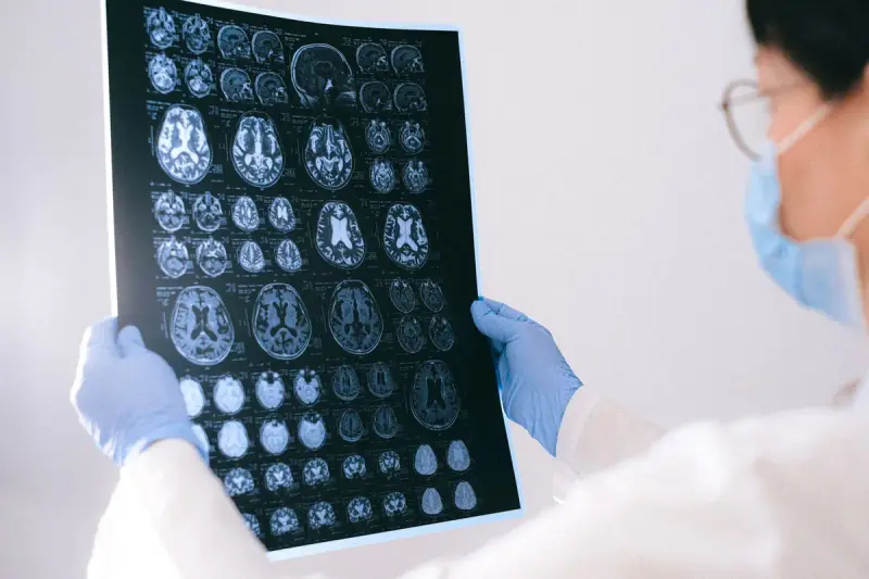 Clinician in blue gloves holding up a sheet of brain MRI images to study them