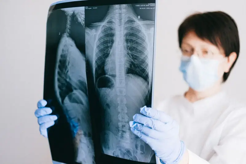 Woman clinician in mask and blue gloves holding up a spine and chest X-ray film