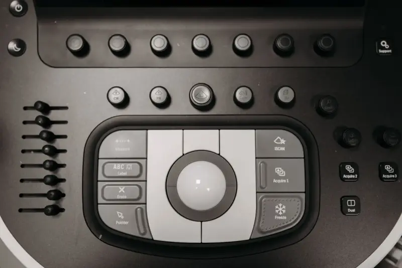 Buttons and trackball on the control panel of a medical ultrasound machine